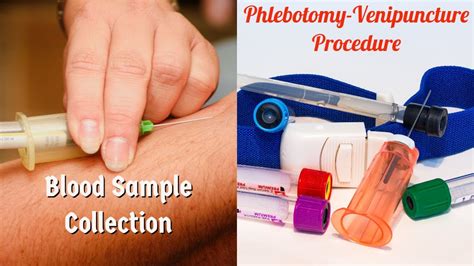 From Medicine to Menace: The Curse of Phlebotomy